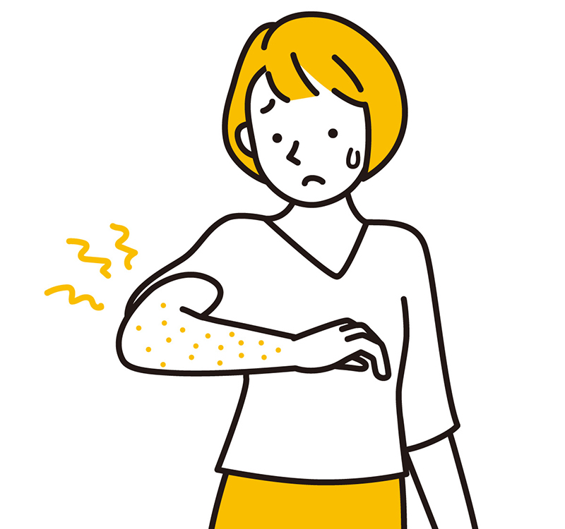 湿疹やかぶれがある