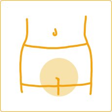 デリケートゾーン