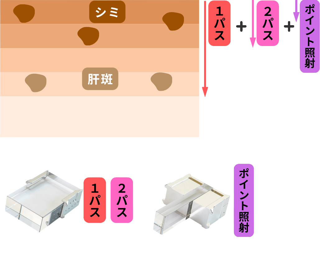 オーダーメイド照射